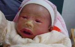 多囊卵巢试管能怀孕吗？多囊患者试管移植计划的费用详细说明！