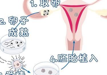 2026在吉林市做基因检测多少钱？基因筛查可以规避哪些遗传病？