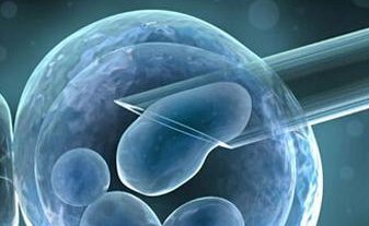 北京地区有哪些私立的机构可以做试管技术？试管婴儿术中卵泡检测有什么用？